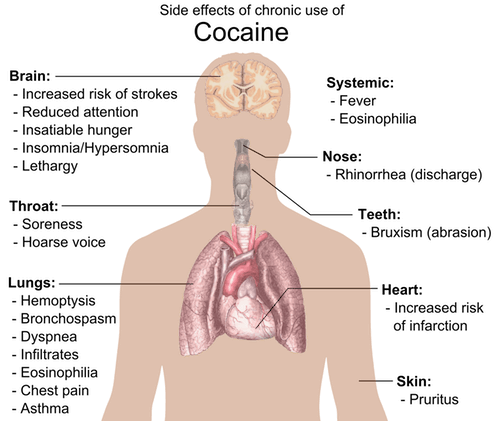 florida cocaine detox center image of body during treatment